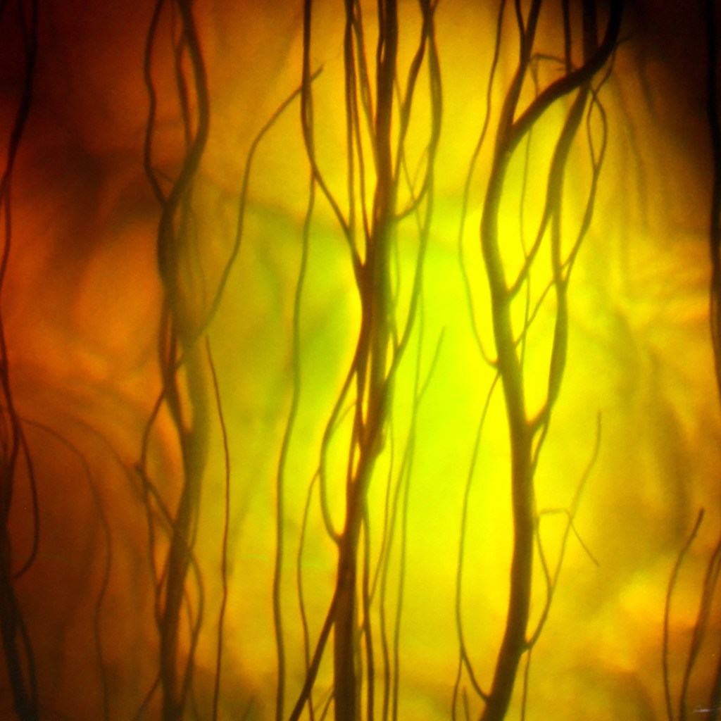 Betsy Connors Holography Trees 2